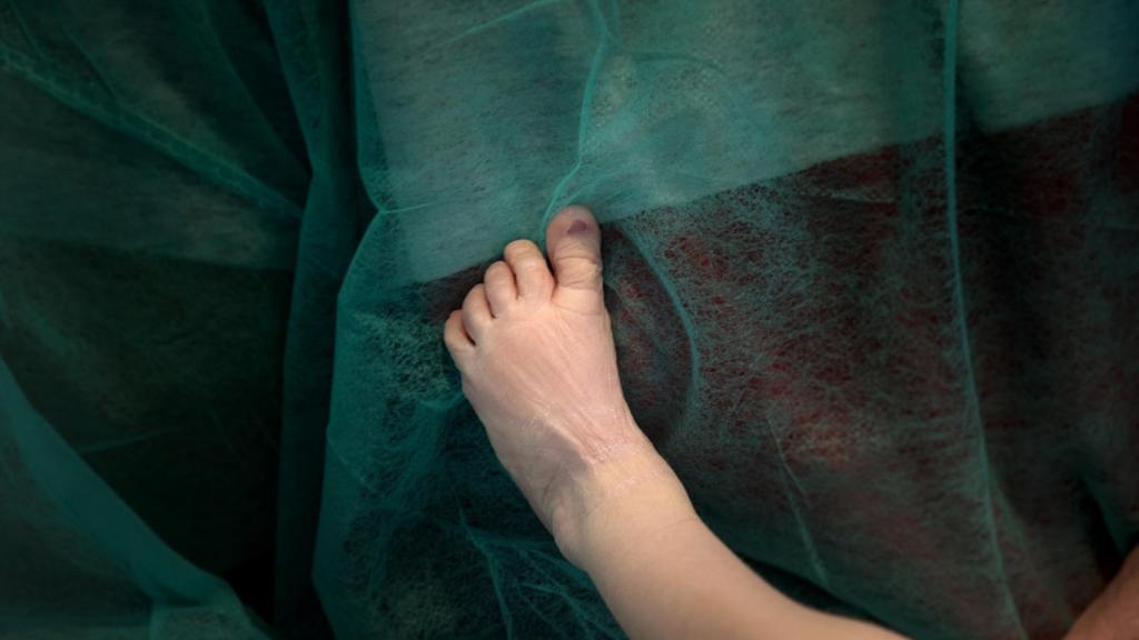 El pie de Aritz en el hospital, en brazos de su padre.