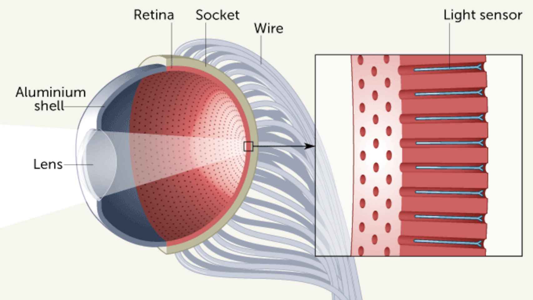 El ojo biónico funciona como uno natural, con una retina hemisférica