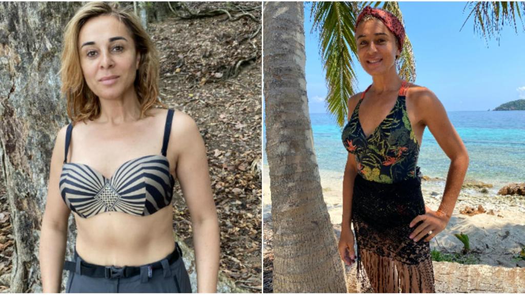 El antes y el después de Ana María.