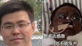 Hu Weifeng, el médico fallecido al que el tratamiento para el COVID-19 volvió la piel negra. Beinjing TV.