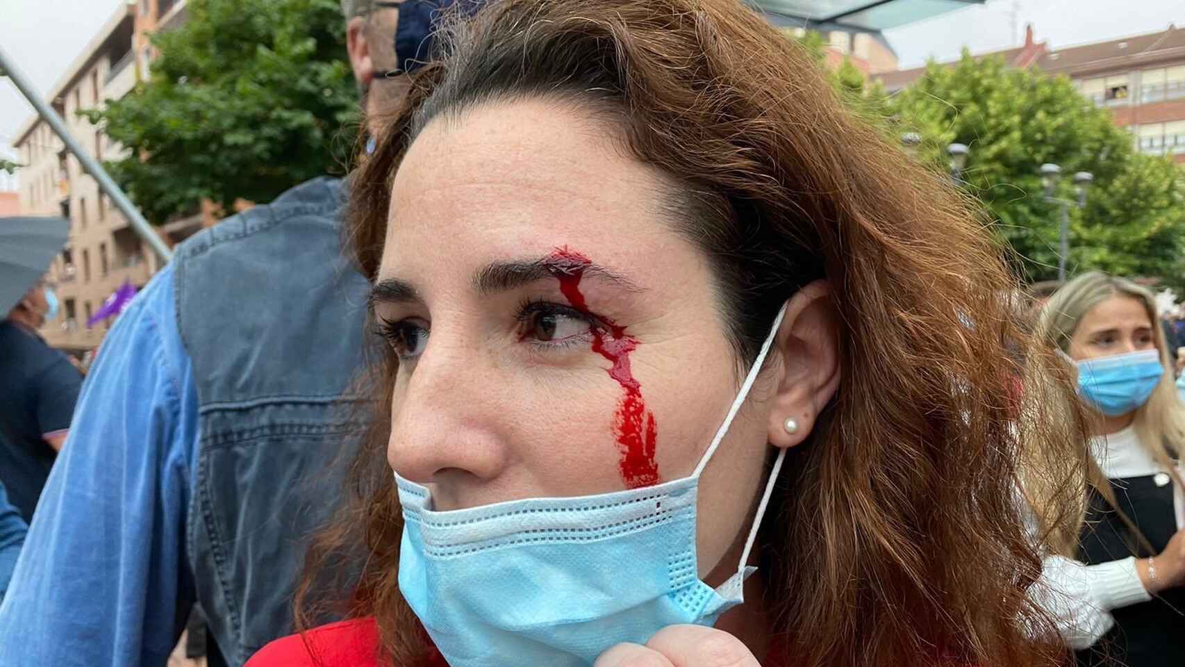La diputada Rocío de Meer, herida tras recibir una pedrada en Sestao. Vox
