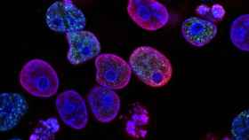 Estas bacterias pueden transportar nanopartículas con fármacos a los tejidos tumorales