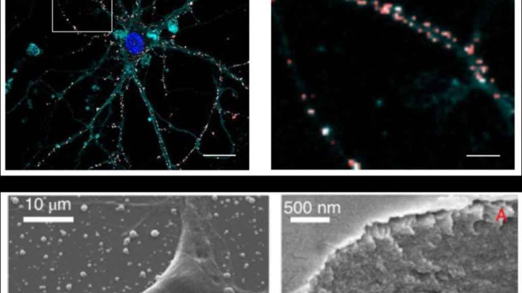 Neurona sobre una capa de nanopartículas empleando un microscopio electrónico
