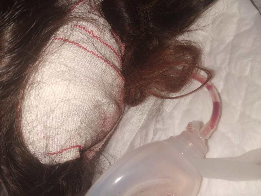La lesión causada a Maria Cristina.