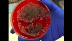 cultivo mascarillas bacterias