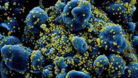 Las partículas del virus Sars-CoV-2 infectando nuestras células.