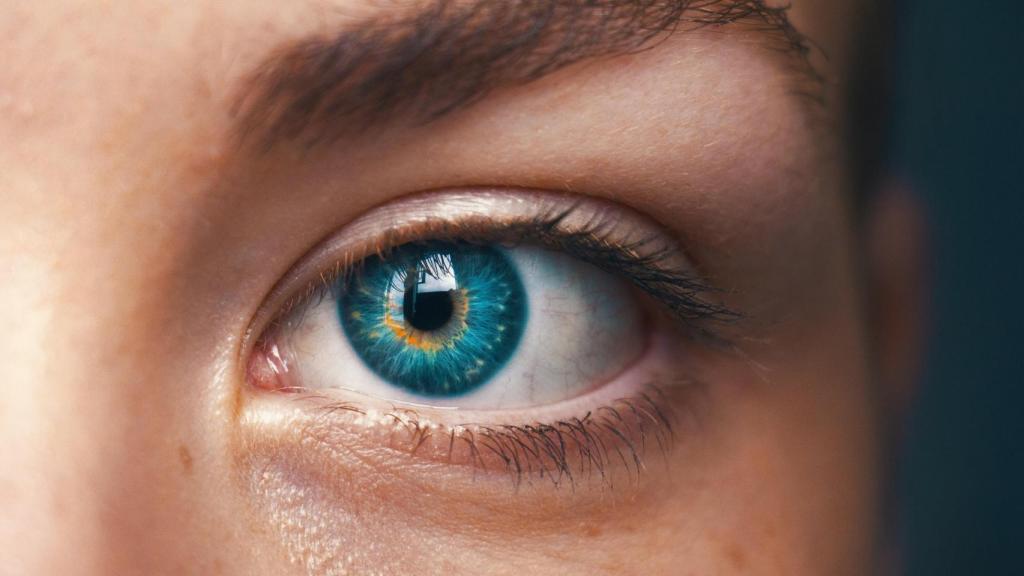 La inyección de ácido hialurónico disminuye las ojeras y las líneas de expresión.