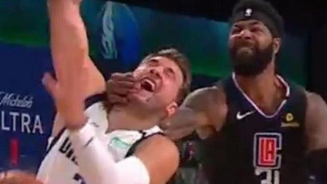 Doncic golpeado por Morris