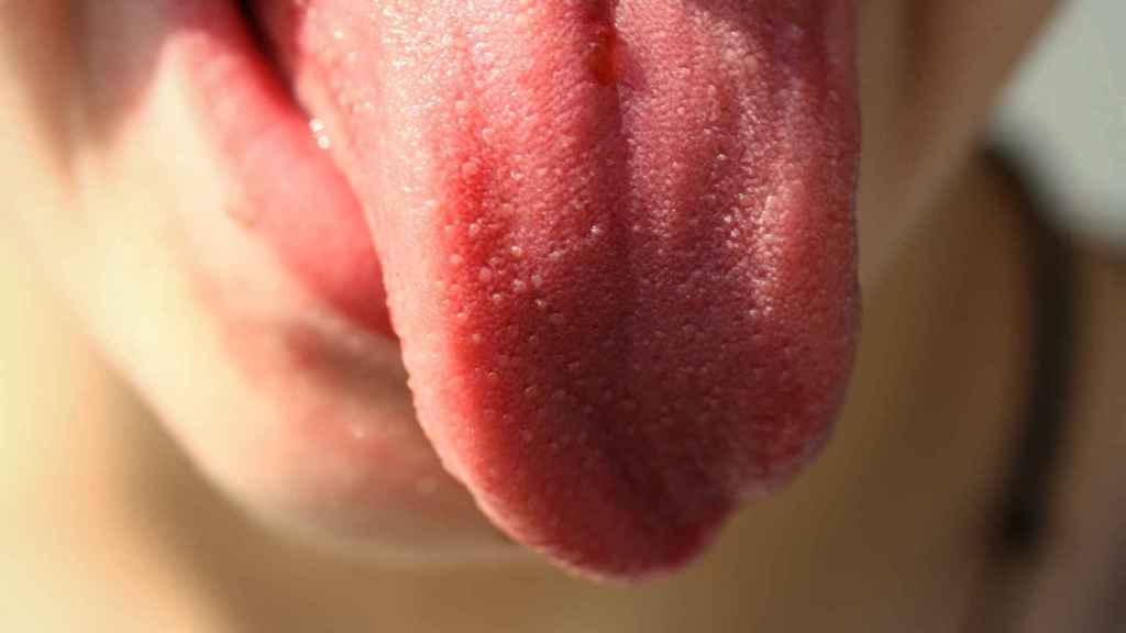 papiloma en lengua sintomas