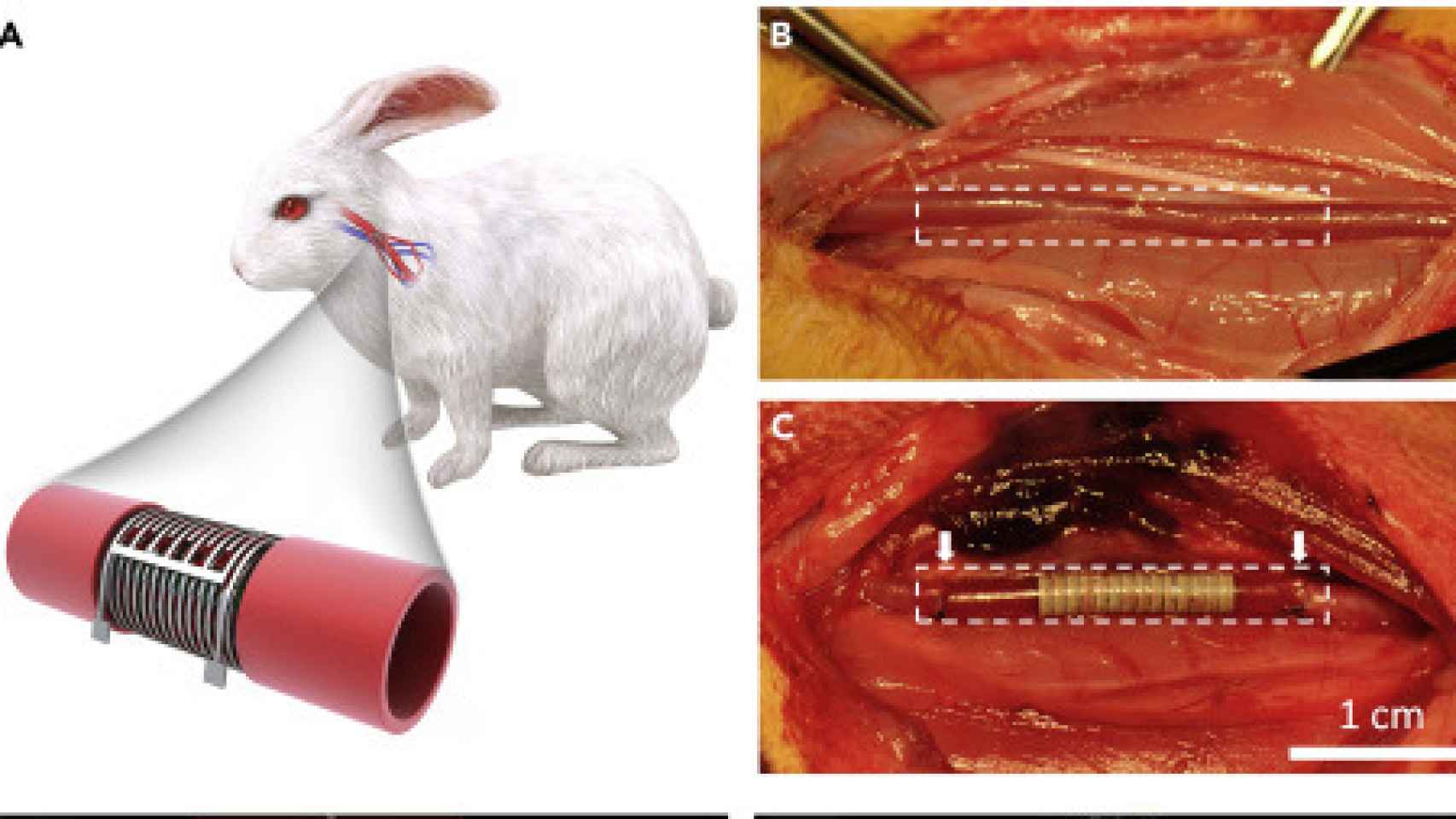 Implante de un vaso sanguíneo electrónico en un conejo