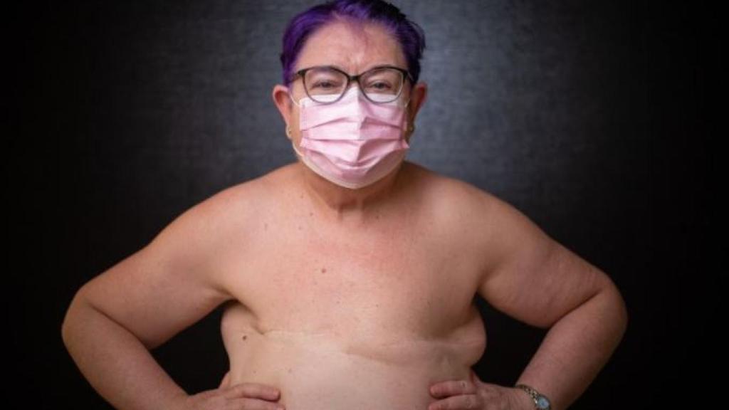 Alicia, enferma de cáncer.