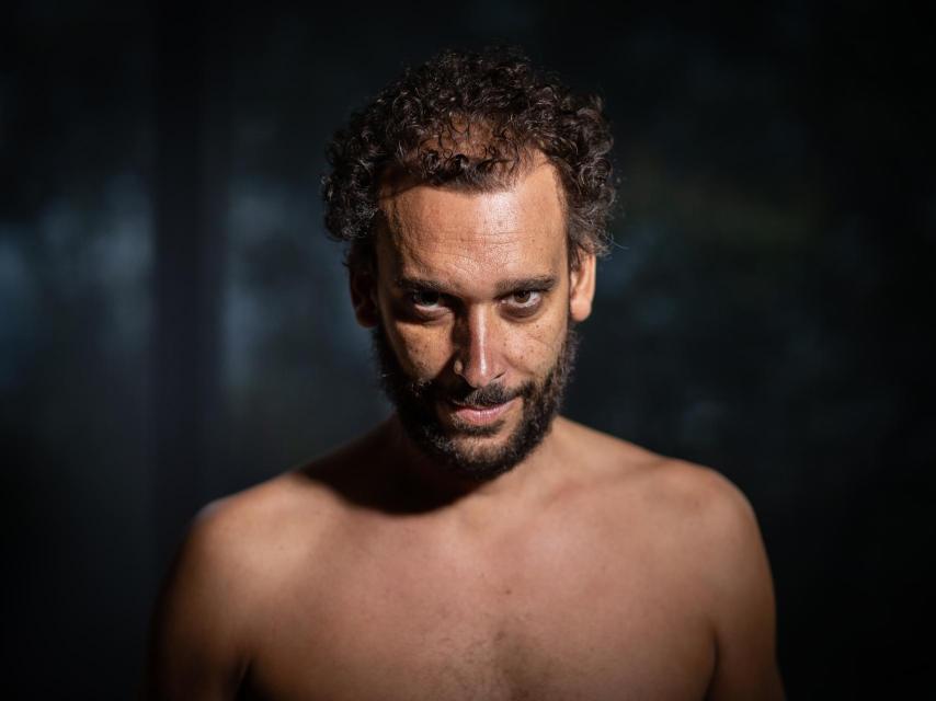 Jesús Candel, 'Spiriman' mostrando su torso tras varias sesiones de quimioterapia.