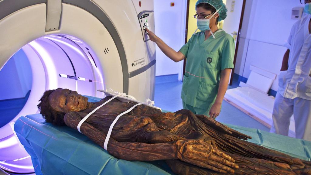 La momia guanche sometiéndose a una Tomografía Axial Computarizada en el Hospital Quirón de Madrid.