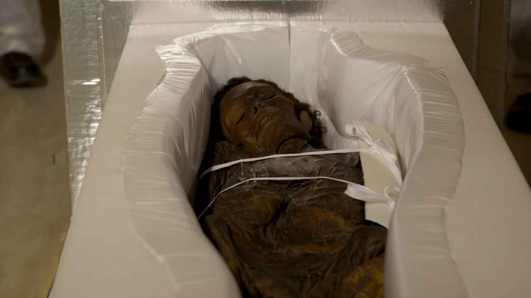Fase de transporte de la momia guanche del Museo Arqueológico Nacional al Hospital Quirón de Madrid.