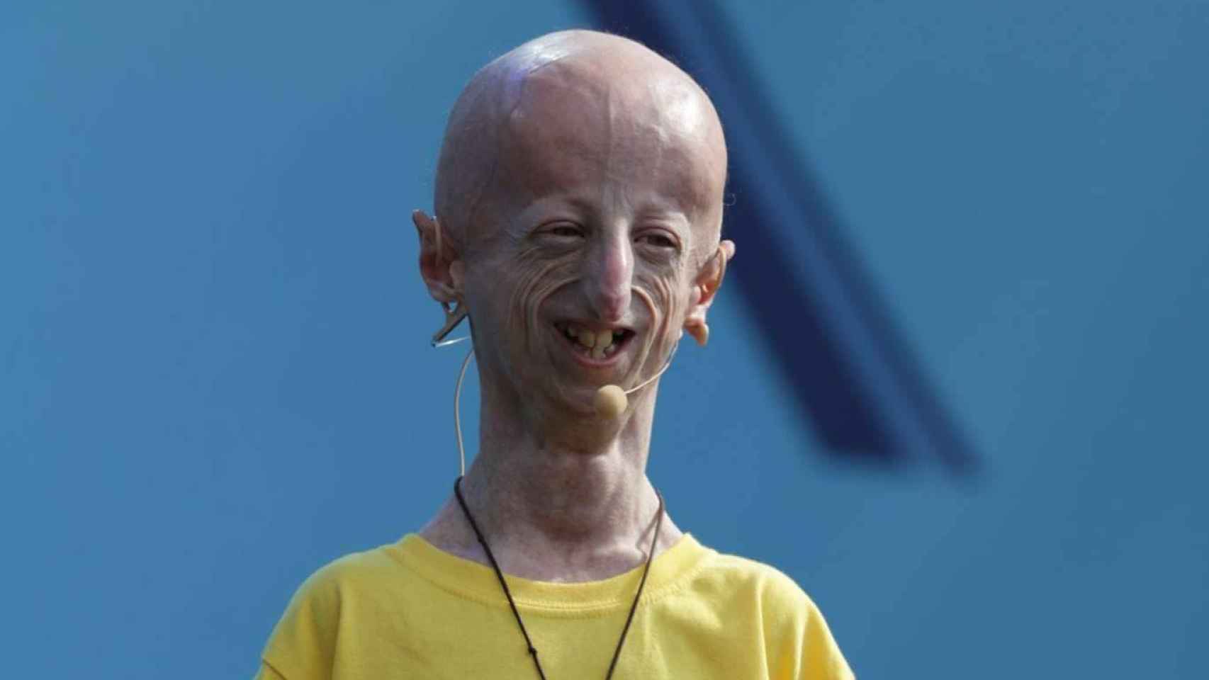 Sammy Basso, biólogo molecular y enfermo de progeria.