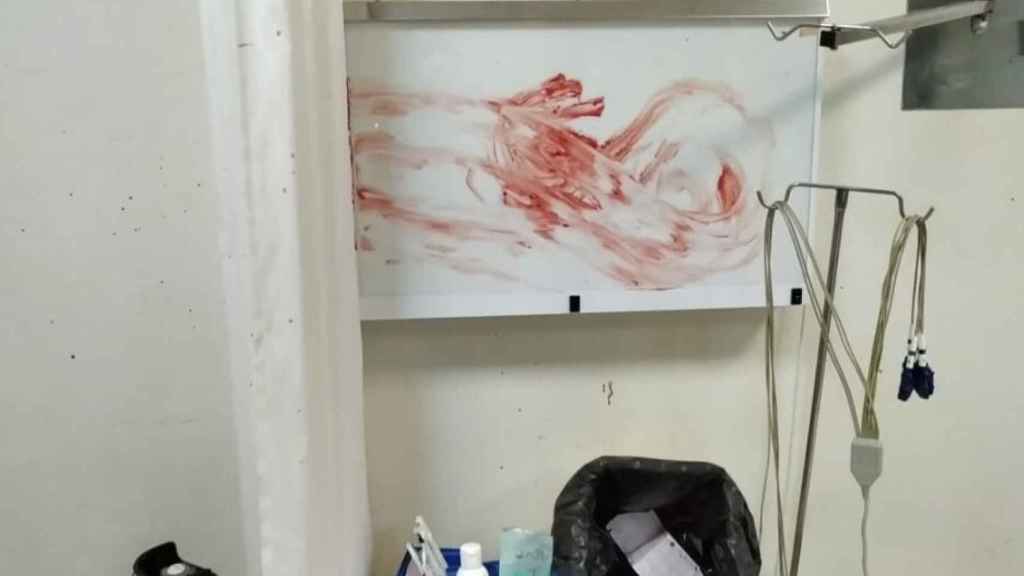 Diego manchó con sangre a propósito el box y el material del Servicio de Urgencias del Centro de Salud Águilas-Norte.