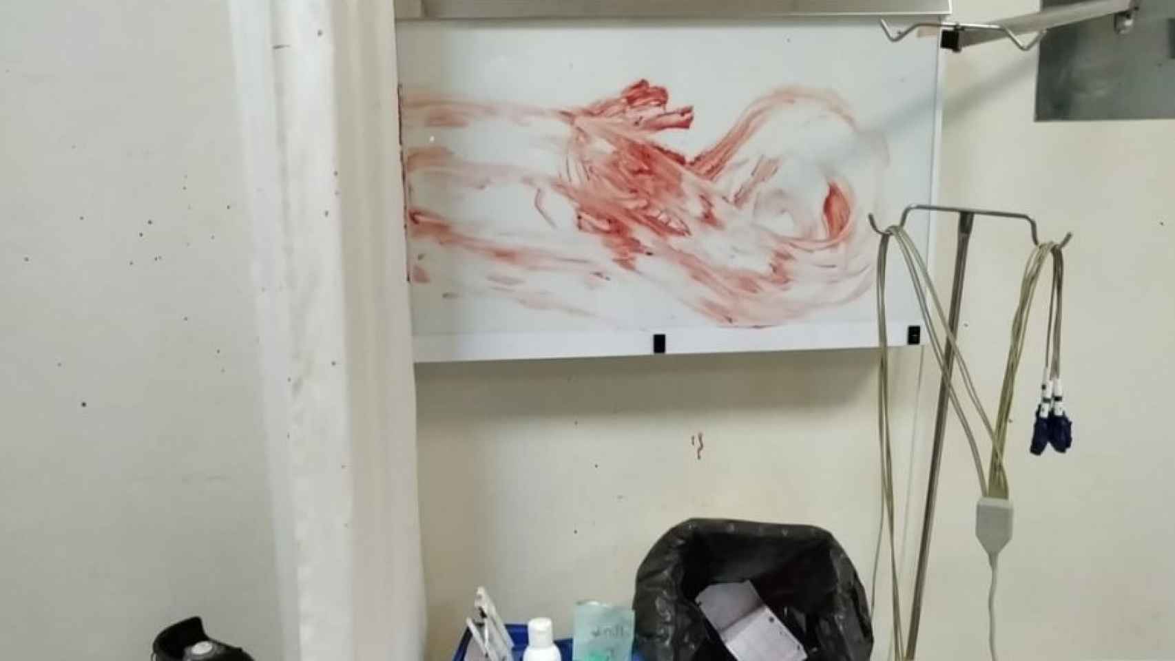 Diego manchó con sangre a propósito el box y el material del Servicio de Urgencias del Centro de Salud Águilas-Norte.