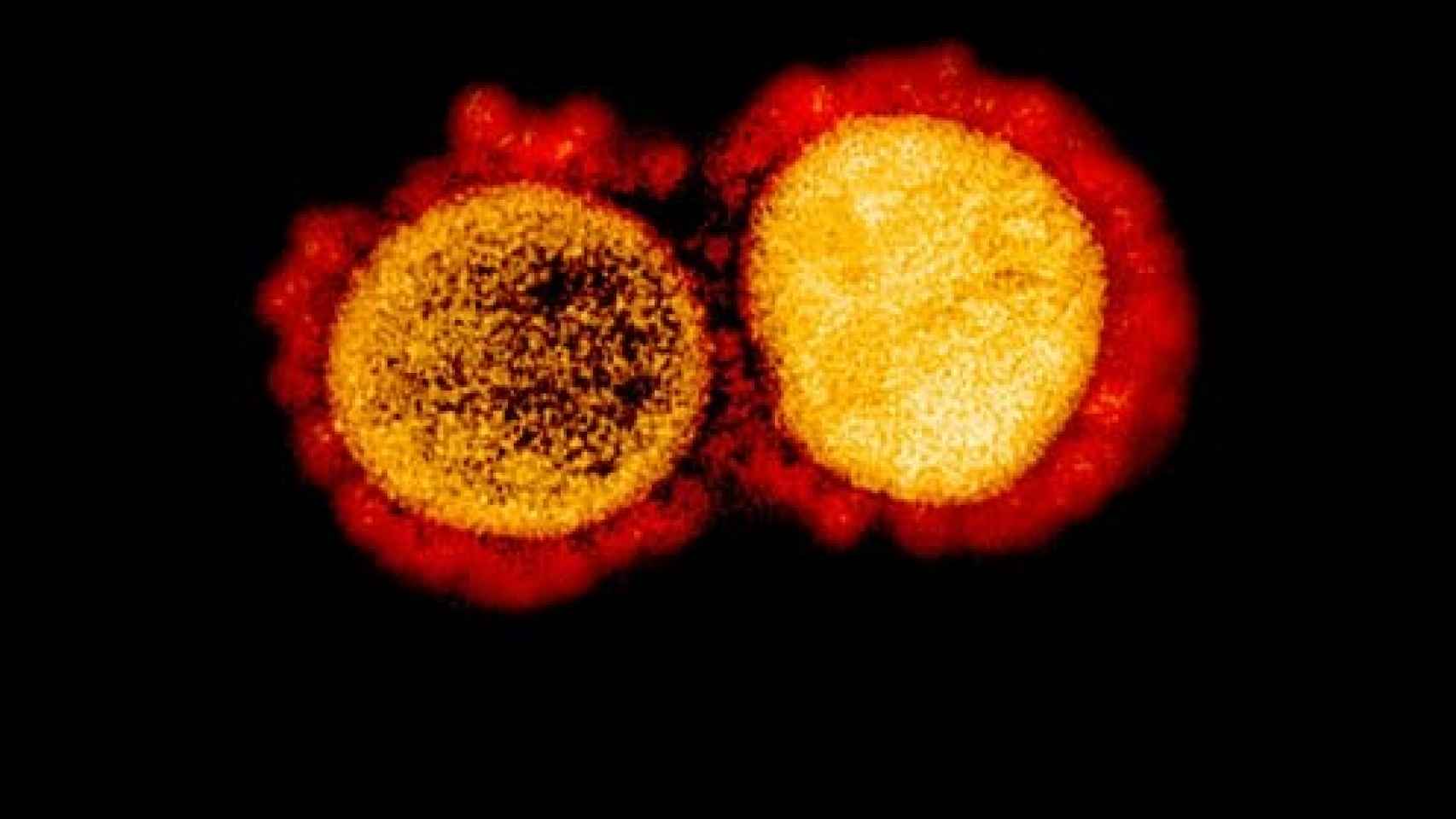 Las partículas del virus Sars-CoV-2.