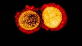 Las partículas del virus Sars-CoV-2.