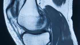Imagen médica de una articulación de rodilla.