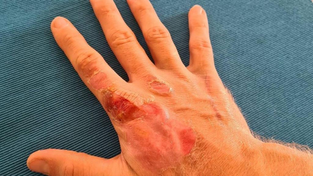 La mano de Grosjean