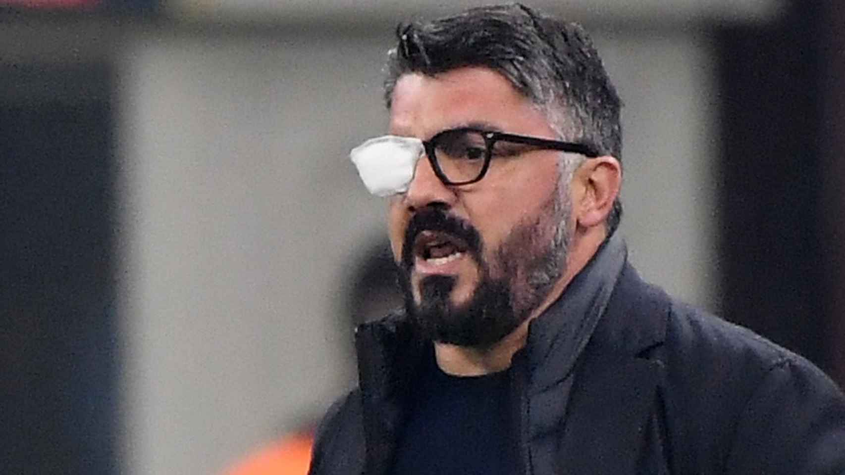 Gennaro Gattuso, con un parche en el ojo, durante un partido del Nápoles