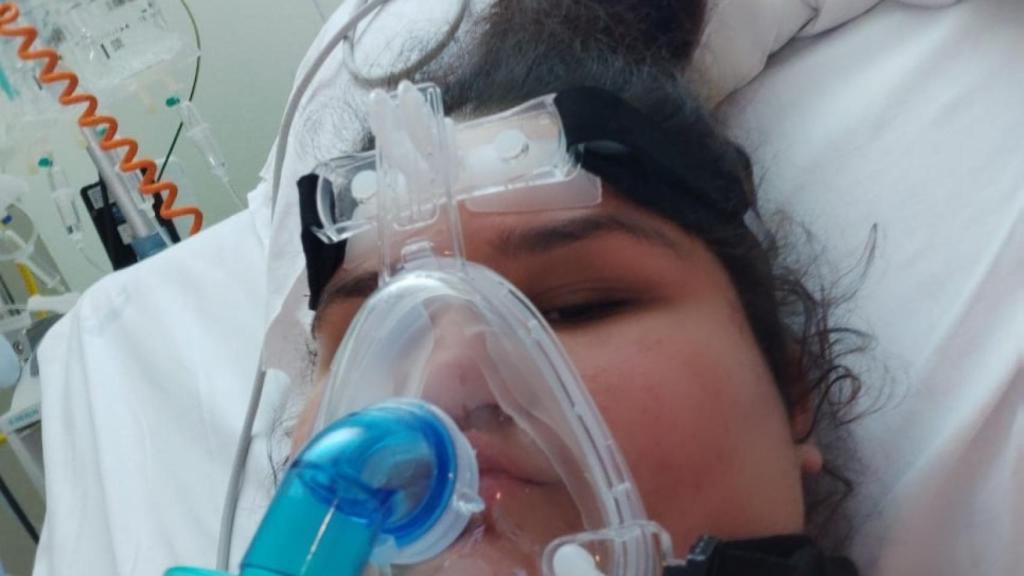 María Sherezade necesitó la ayuda de la ventilación mecánica para poder respirar.