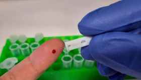 Imagen de la extracción de la gota de sangre necesaria para el test de anticuerpos. Foto: CBM-CSIC-UAM