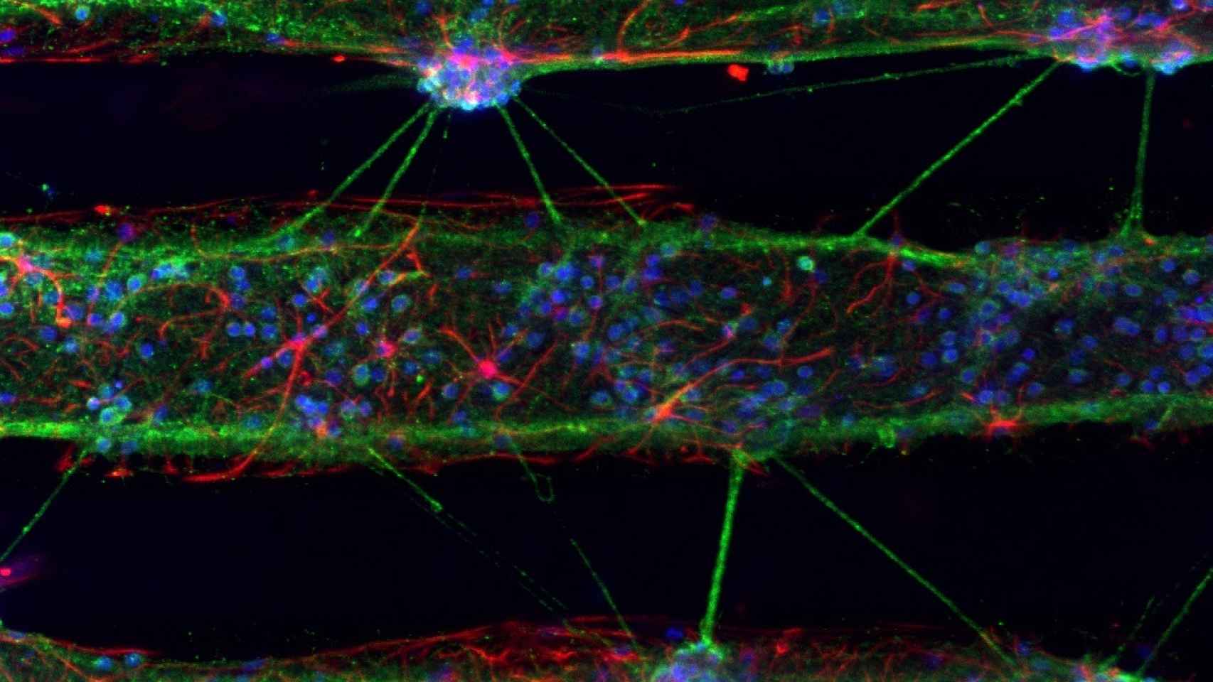 Cultivos neuronales marcados con anticuerpos fluorescentes.