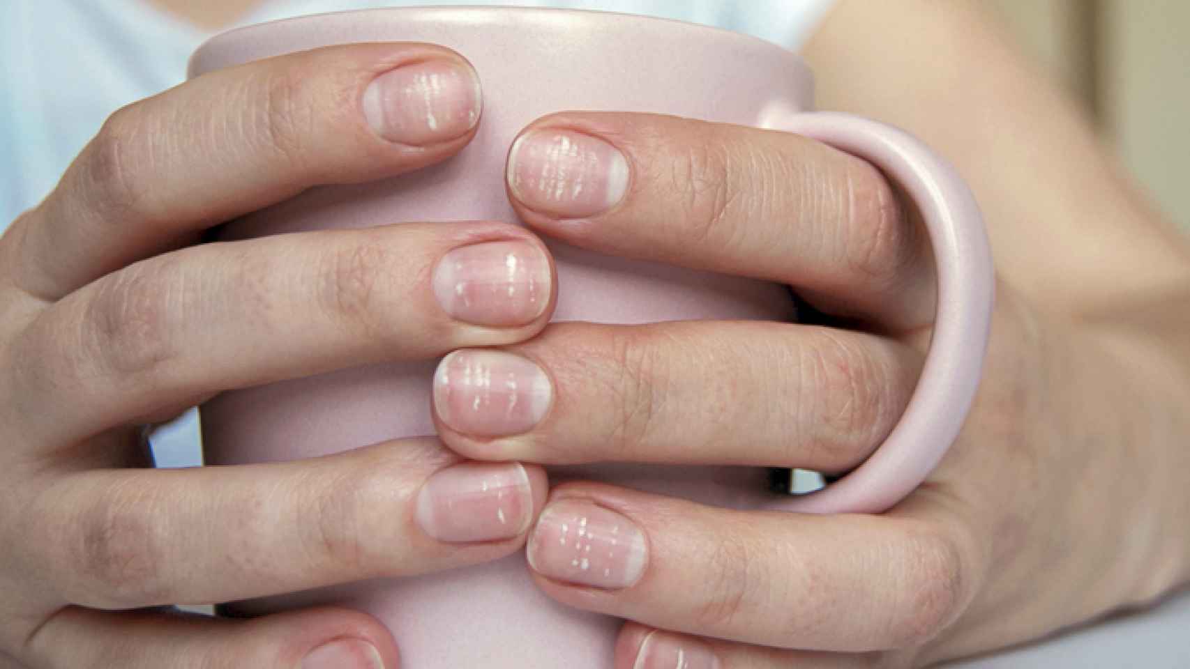 Las cosas que tus uñas te pueden estar diciendo sobre salud