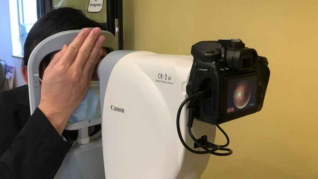 Escáner de retina capaz de detectar autismo