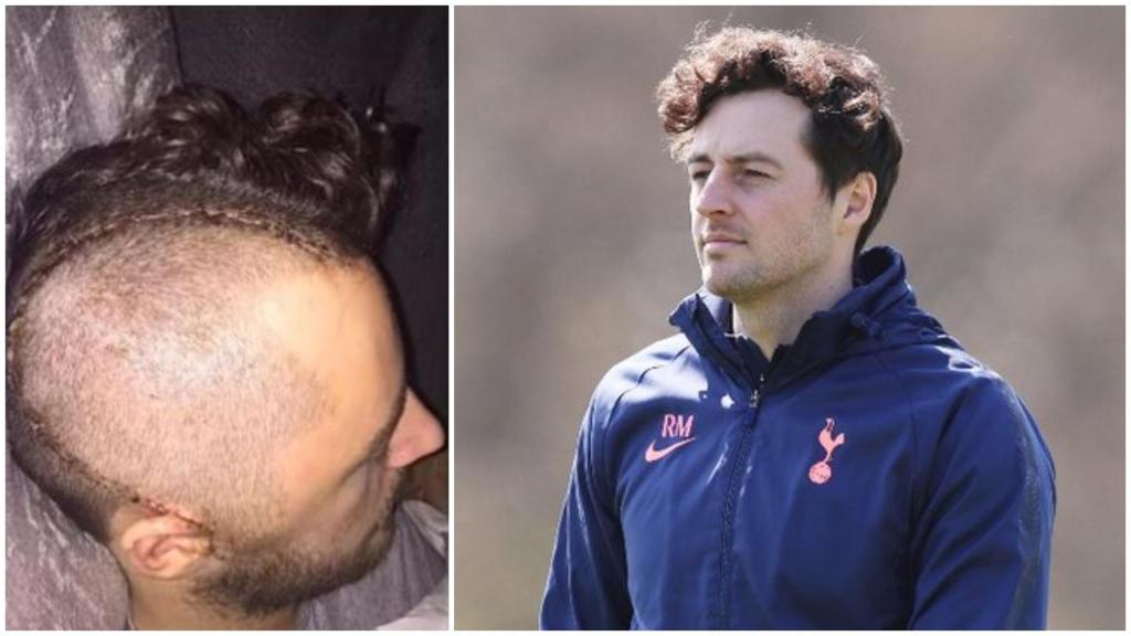 Ryan Mason
