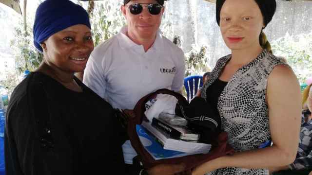 El presidente de la ONG Unión por el Bienestar de los Albinos de Guinea-Conakri, Kabinet Camara