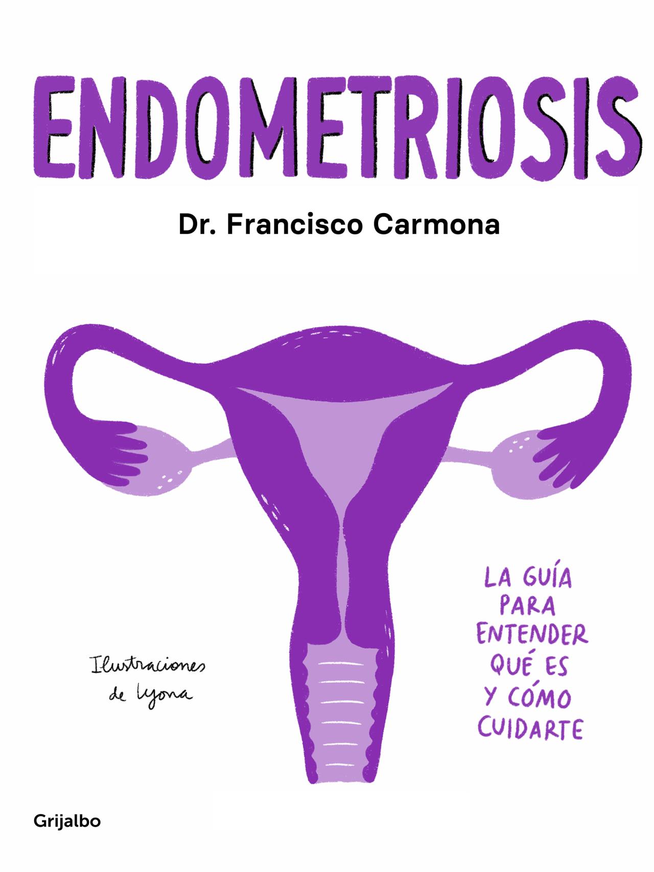 Las Diez Claves Para Entender La Endometriosis: Desde Síntomas A ...