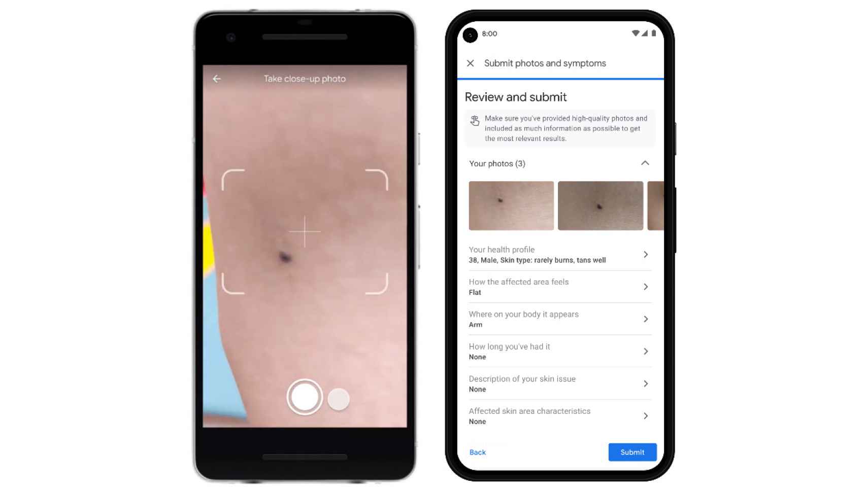 Google detectará el cáncer de piel con sólo una foto hecha con tu móvil