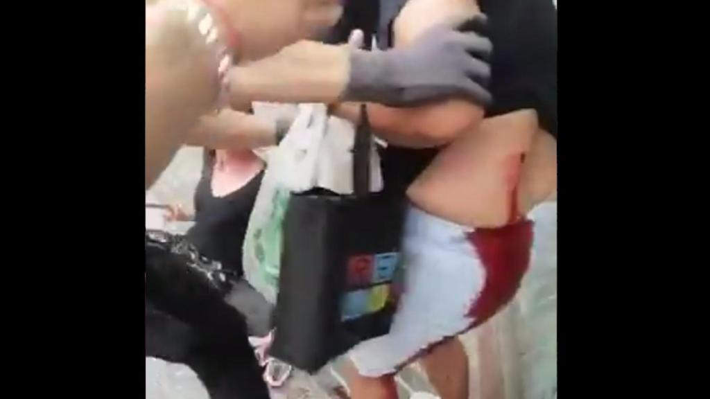 Imágenes de la agresión racista en Cartagena.