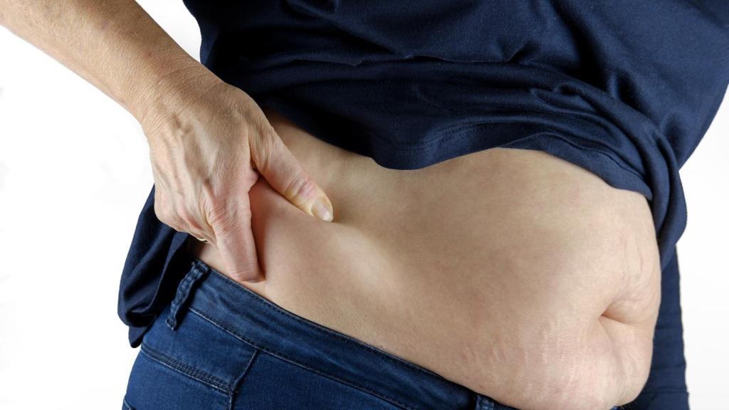 El sobrepeso es otro de los factores de riesgo, al igual que las dietas yoyó.