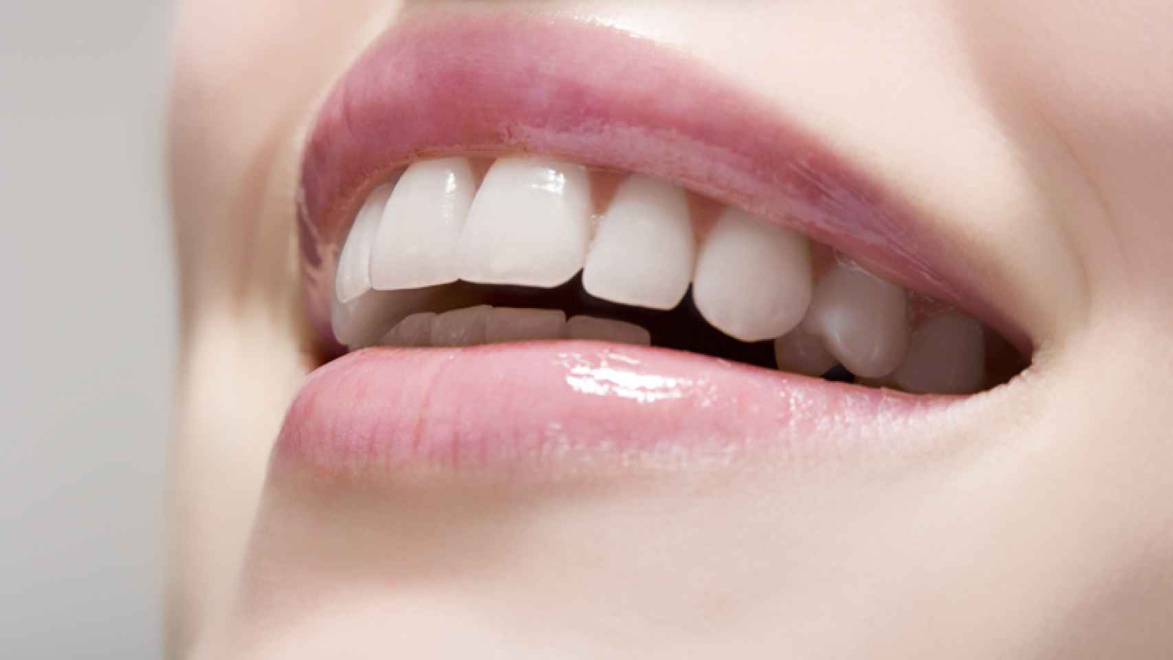 Fascinar col china traicionar Dientes blancos: 7 remedios naturales para tener la sonrisa perfecta