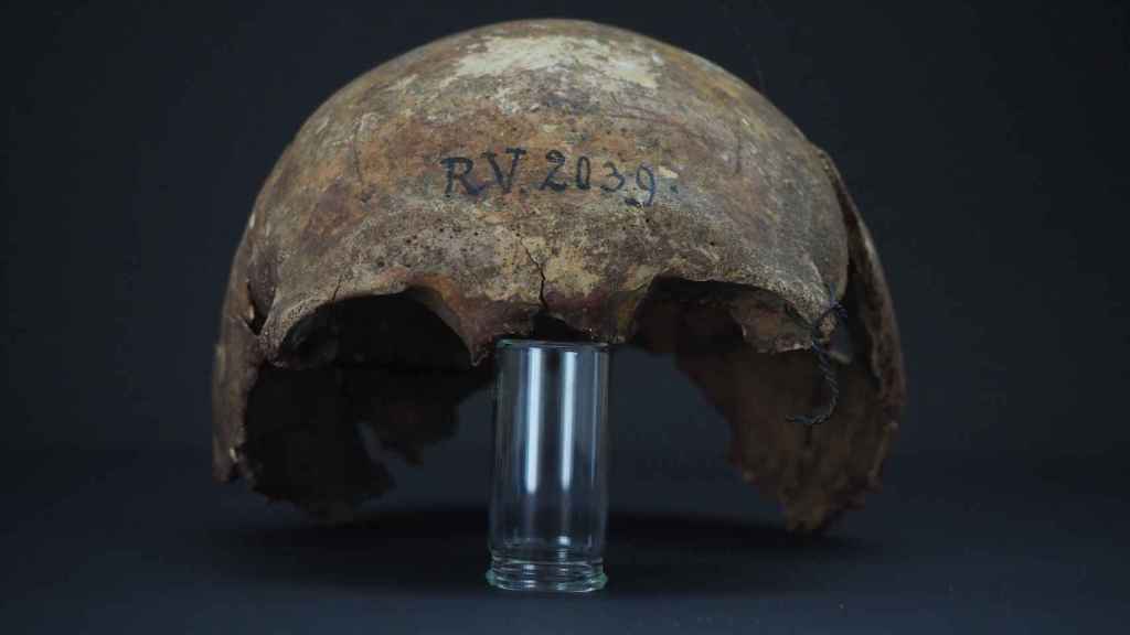 Restos del cráneo del individuo adulto de hace 5.000 años que presentaba la primera variante de peste conocida.