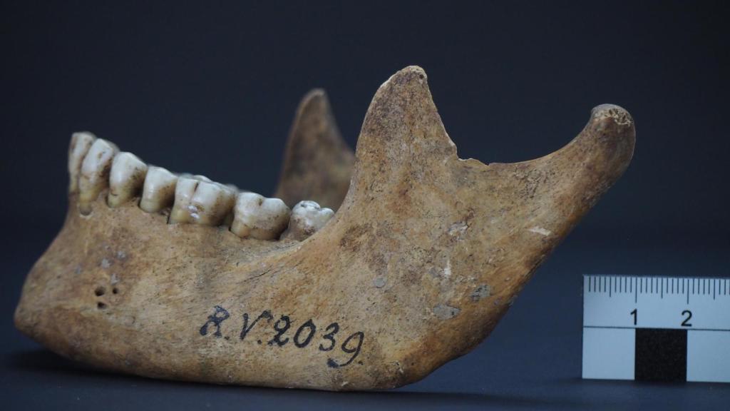 Mandíbula del hombre enterrado Riņņukalns hace unos 5.000 años.