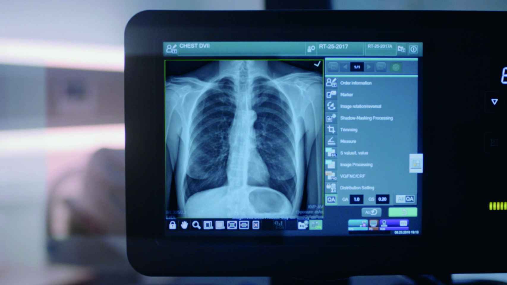 Una radiografía con uno de los equipos de Fujifilm.
