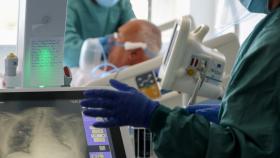 Imagen de los pulmones de un paciente enfermo de Covid en el Hospital del Mar, en Barcelona.