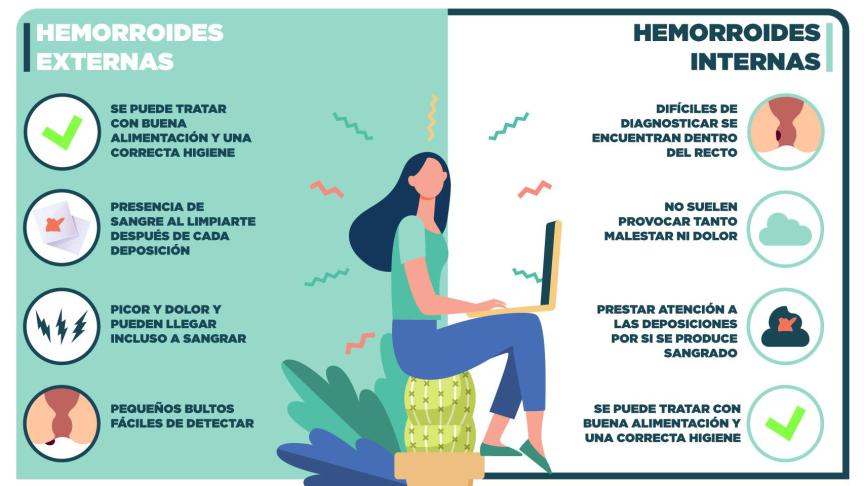 Así Puedes Prevenir Y Curar Las Hemorroides