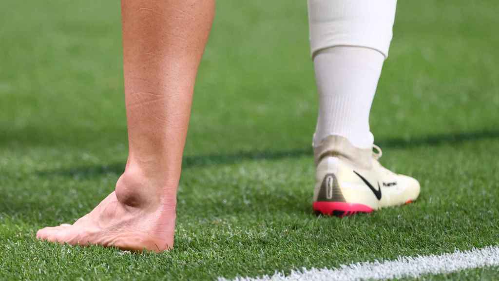 El tobillo de Dani Ceballos tras lesionarse en los Juegos Olímpicos de Tokio 2020