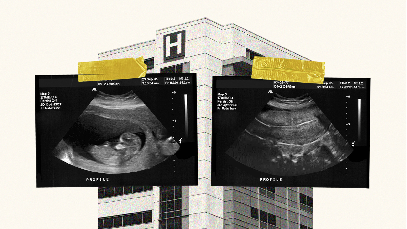 Radiografía de las comunidades autónomas que no practican abortos en sus servicios públicos.