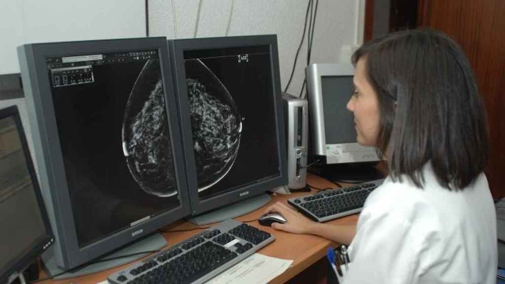 Especialista revisando una mamografía.