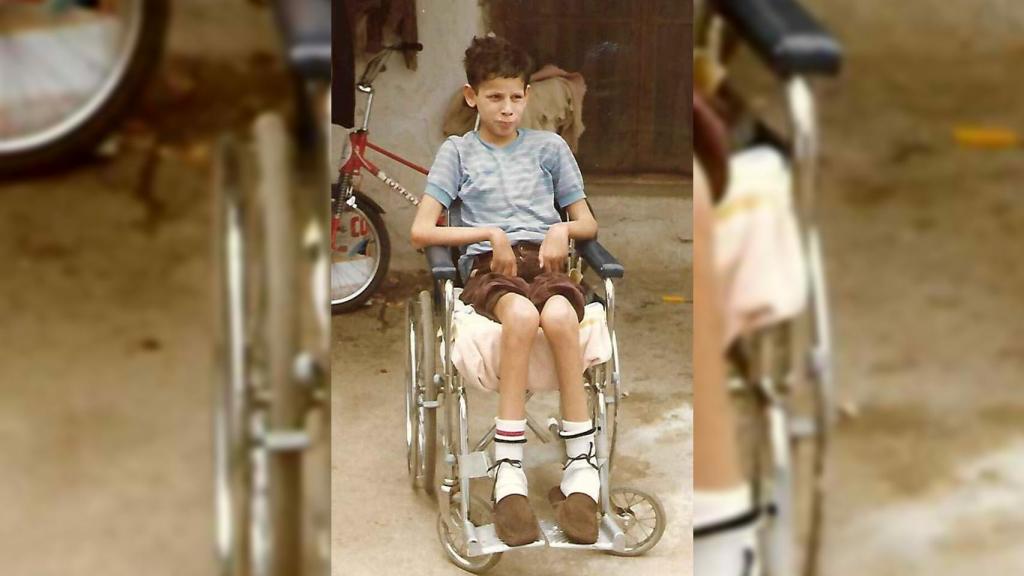 Una de las primera fotografías de un joven Miguel Ángel tras su envenenamiento.