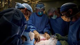 Los cirujanos observan el órgano del cerdo implantado de forma externa en un ser humano. Joe Carrotta for NYU Langone Health/Reuters
