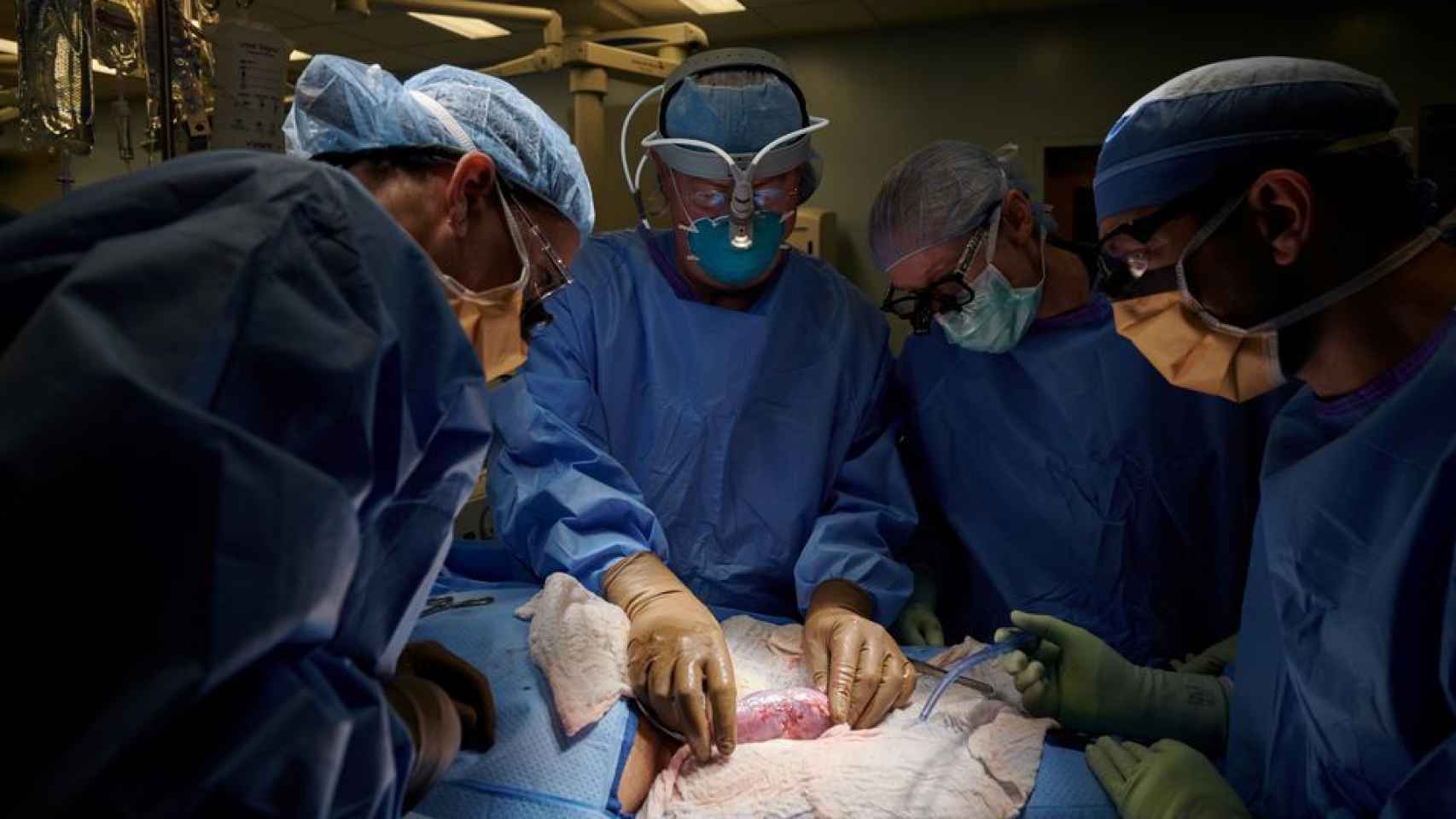 Los cirujanos observan el órgano del cerdo implantado de forma externa en un ser humano. Joe Carrotta for NYU Langone Health/Reuters