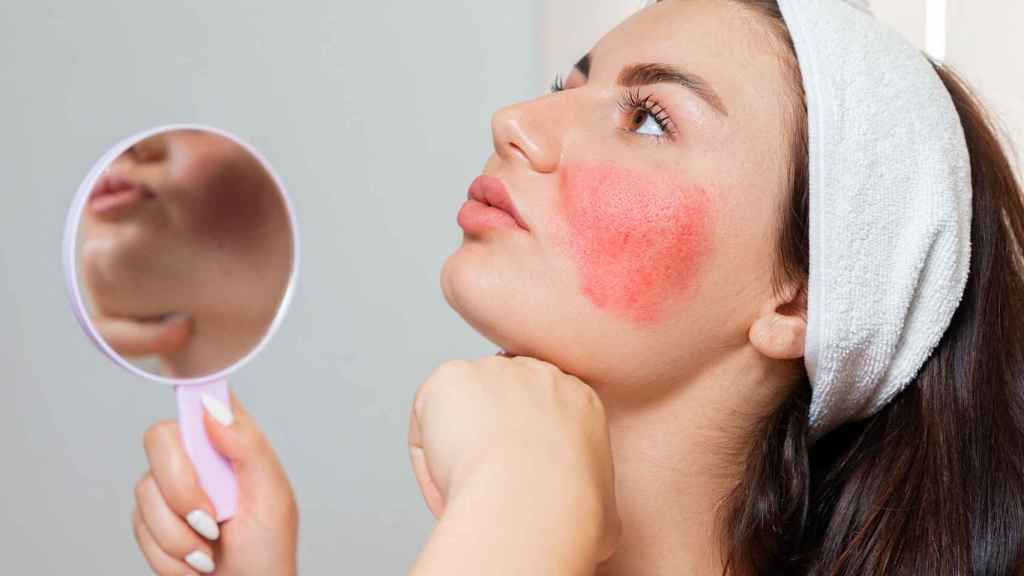 Casi el 20% de la población es alérgica a algún componente de los cosméticos.